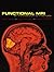 Functional MRI: An Introduc...