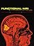 Functional MRI: An Introduction to Methods