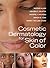 Cosmetic Dermatology for Skin of Color