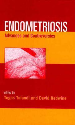Endometriosis: Advances and Controversies (Hardcover)
