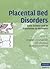 Placental Bed Disorders: Basic Science and its Translation to Obstetrics (Cambridge Medicine (Hardcover))