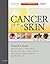 Cancer of the Skin: Expert ...