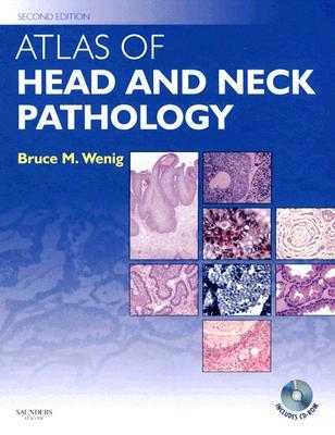 Atlas of Head and Neck Pathology with CD-ROM (Atlas of Surgical Pathology)