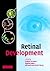 Retinal Development