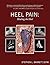 Heel Pain: Healing the Heel
