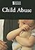 Child Abuse (Introducing Issues With Opposing Viewpoints)