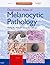 Diagnostic Atlas of Melanocytic Pathology: Expert Consult: Online and Print