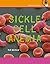 Sickle Cell Anemia