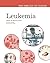 Leukemia (The Biology of Cancer)