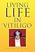 Living Life In Vitiligo