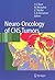 Neuro-Oncology of CNS Tumors