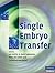 Single Embryo Transfer