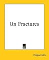 On Fractures