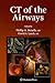 CT of the Airways by Phillip M. Boiselle