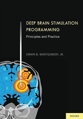 Deep Brain Stimulation Programming: Principles and Practice (Hardcover)