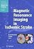 Magnetic Resonance Imaging in Ischemic Stroke (Medical Radiology)