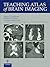 Teaching Atlas of Brain Imaging by Nancy J. Fischbein