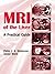 MRI of the Liver: A Practical Guide
