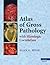 Atlas of Gross Pathology: With Histologic Correlation