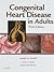 Congenital Heart Disease in Adults