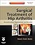 Surgical Treatment of Hip Arthritis by William J. Hozack