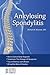 Ankylosing Spondylitis