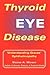 Thyroid Eye Disease: Understanding Graves' Ophthalmopathy