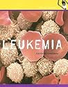 Leukemia (Health Alert)