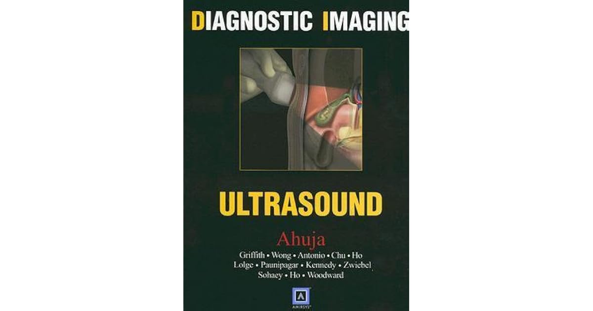 Diagnostic Imaging Ultrasound by Anil T. Ahuja