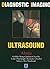 Diagnostic Imaging: Ultrasound