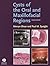 Cysts of the Oral and Maxillofacial Regions