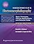 Niedermeyer's Electroencephalography: Basic Principles, Clinical Applications, and Related Fields