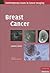 Breast Cancer