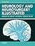 Neurology and Neurosurgery Illustrated