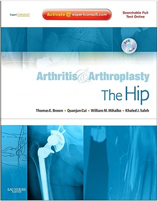 Arthritis and Arthroplasty: The Hip: Expert Consult - Online, Print and DVD (Hardcover)