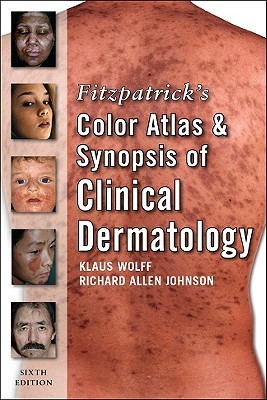 Fitzpatrick's Color Atlas and Synopsis of Clinical Dermatology (Paperback)