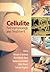 Cellulite: Pathophysiology and Treatment (Basic and Clinical Dermatology)