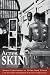Acres of Skin: Human Experiments at Holmesburg Prison