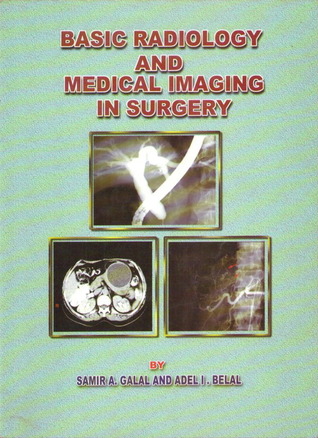 Basic Radiology and Medical Imaging in Surgery