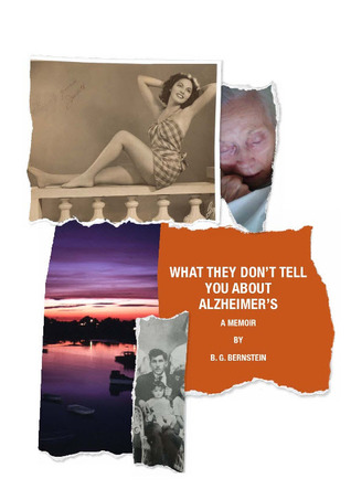 What They Don't Tell You About Alzheimer's 