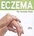 Eczema: The Essential Guide