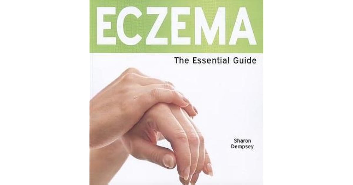 Eczema The Essential Guide by Sharon Dempsey