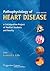 Pathophysiology of Heart Disease by Leonard S. Lilly Pathophysiology of Heart Disease by Leonard S. Lilly