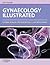 Gynaecology Illustrated