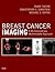 Breast Cancer Imaging E-Boo...