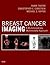 Breast Cancer Imaging E-Book by Marie Tartar