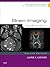 Brain Imaging: Case Review Series: Brain Imaging: Case Review Series E-Book
