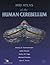 MRI Atlas of the Human Cere...
