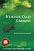 Polycystic Ovary Syndrome - Ecab