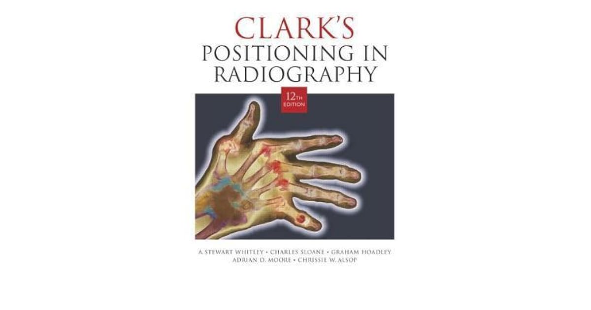 Clark's Positioning Radiography by A. Stewart Whitley